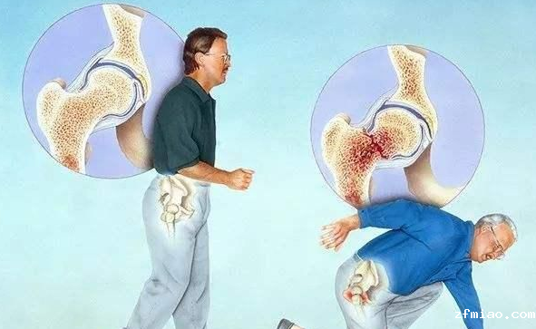 超声骨密度检测仪的应用范围 超声骨密度检测仪的应用范围(图1)