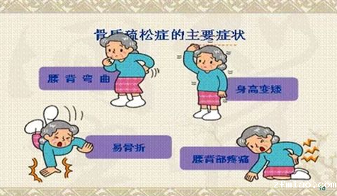 便携式骨密度仪厂家国康提示日常坏习惯导致才30岁就"骨质疏松"了