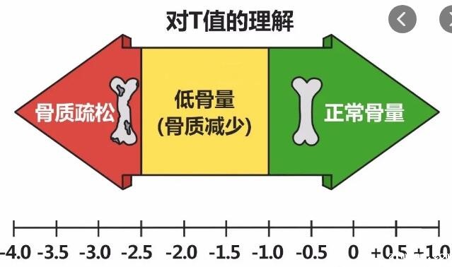 新利18体育娱乐app菲律宾骨密度仪厂家研发的骨密度的测量方式 新利18体育娱乐app菲律宾骨密度仪厂家研发的骨密度的测量方式