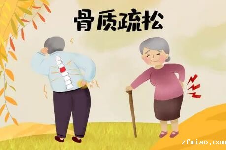 便携式骨密度仪生产厂家提醒女士骨质疏松的查验