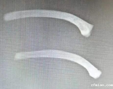 GK-7000骨密度检测仪品牌国康再谈骨质疏松与蛋白质联系