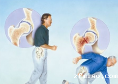 价位合理检测量高的超声骨密度测试仪厂家去哪里购买?