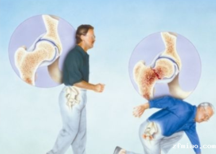 价位合理检测量高的超声骨密度测试仪厂家去哪里购买？