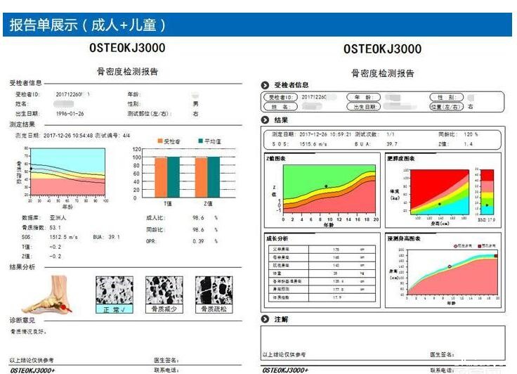 影响骨密度仪器的价钱的要素有哪些?国康4.20bot