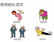 国产骨密度仪生产厂家国康提问补足钙,能远离“骨质疏松症”吗?