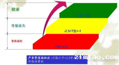 超声骨密度仪可以轻松的告诉你骨密度正常值是多少从而判断骨质量的一个重要