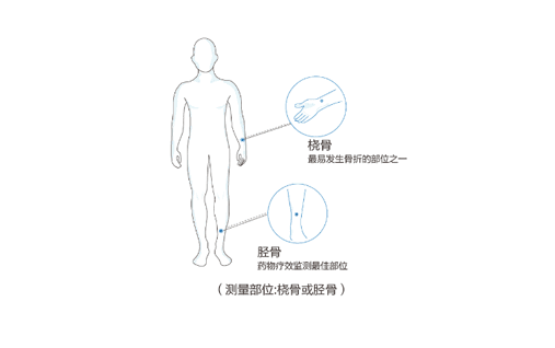 超声波法最为普遍,无辐射检测应该是说的超声检测,检测原理利用骨质对超声衰减度和声速的变化
