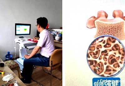 我们医院近期要采购一台超声骨密度检测仪但是选择出现分歧