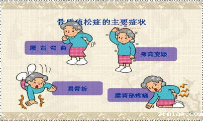 超声骨密度分析仪品牌国康建议除了骨密度外，这是骨质疏松症治疗最重要的监测指标!