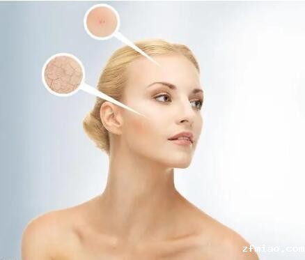 超声骨密度仪生产厂家提示皮肤干燥的女性更容易骨折