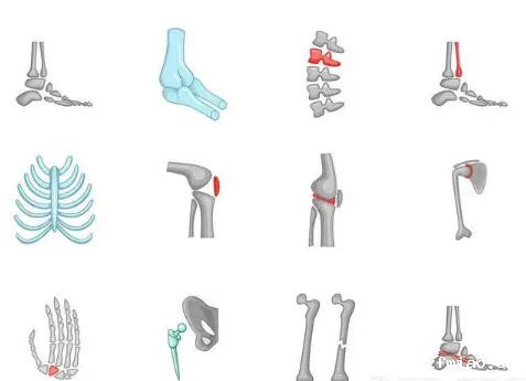 超声骨密度检测仪厂家提示你知道哪些不良习惯会损伤人体骨骼吗？