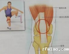 关节活动的响声，超声波骨密度分析仪器检测结果是警醒还是福音？